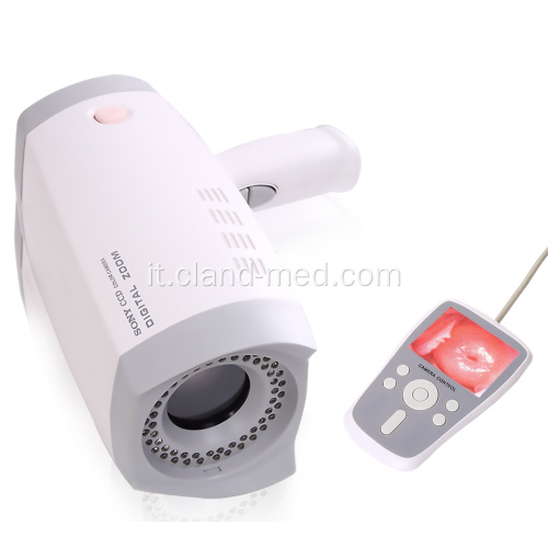 Fotocamera digitale Full HD palmare per colposcopio della vagina